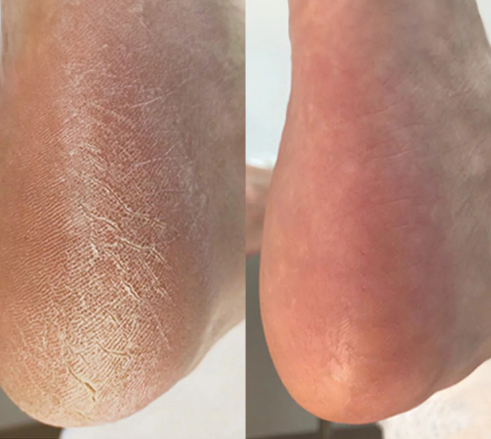<p><strong>Regular people. Fantastic results.</strong></p>