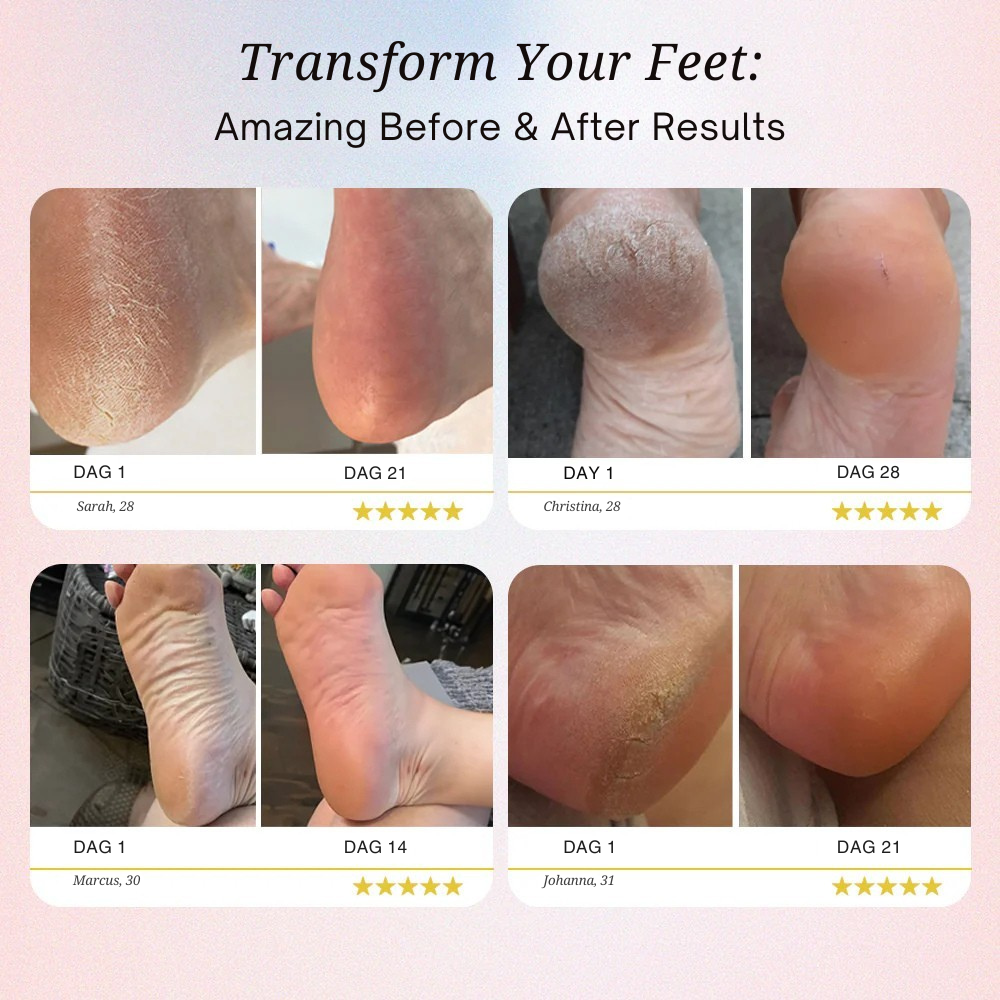 Lovi Pedi Pro 2