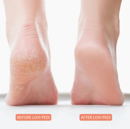 Lovi Pedi Pro 2